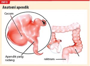apendiks 300x220 Penyakit Kantung 