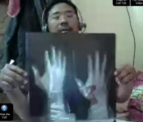 xray tangan