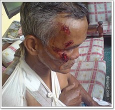 ayah cedera 230x220 Dibakar Tidak Hangus Dan Direndam Tidak Basah